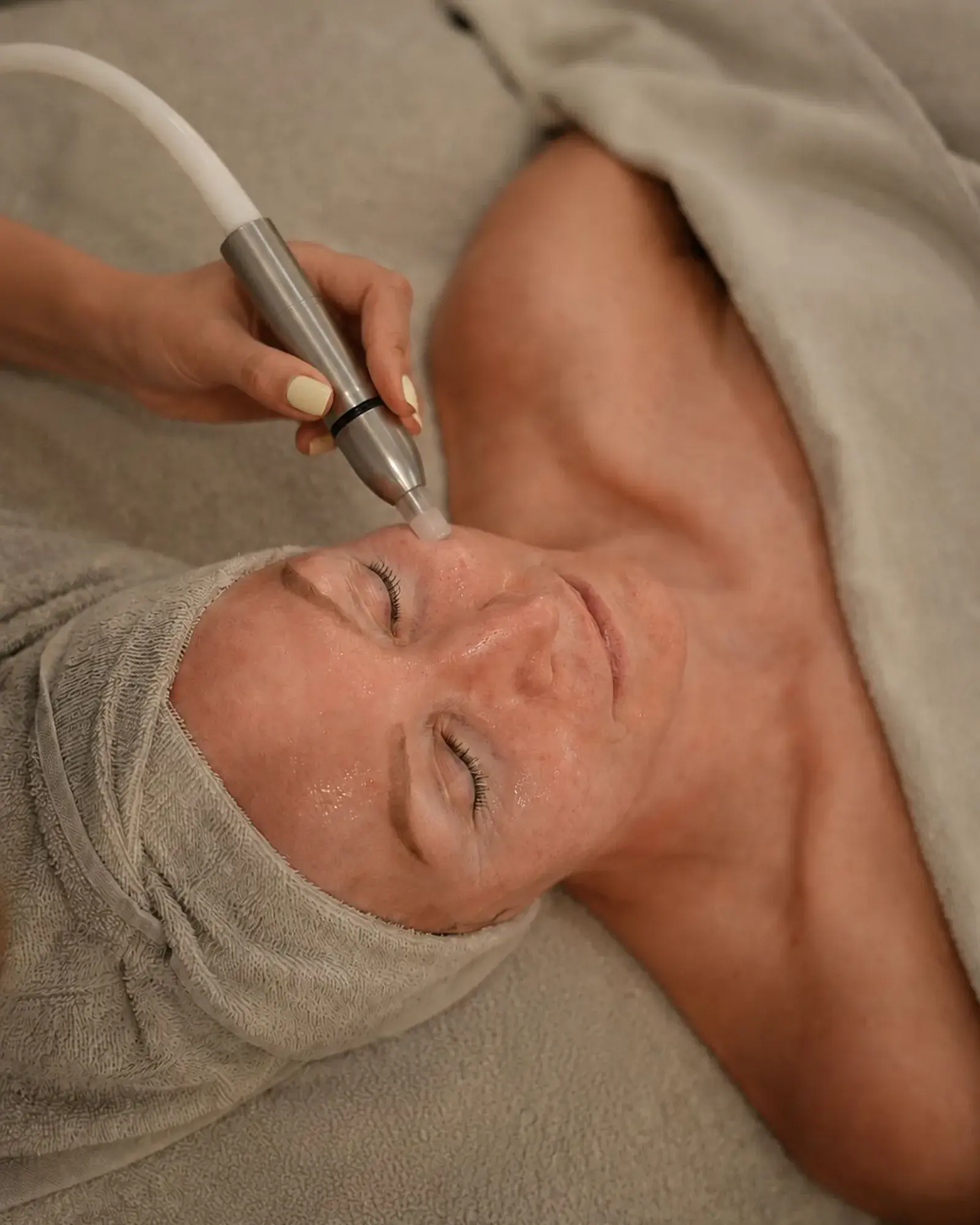 Mikrodermabrasion-Behandlung im House of Shido